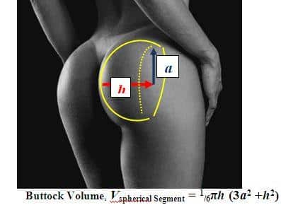Memphis Buttock Augmentation